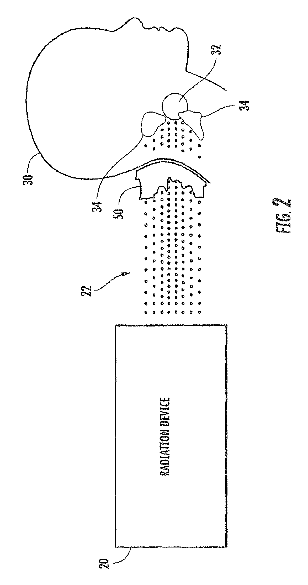 Radiation therapy using beam modifiers placed against a patient's skin