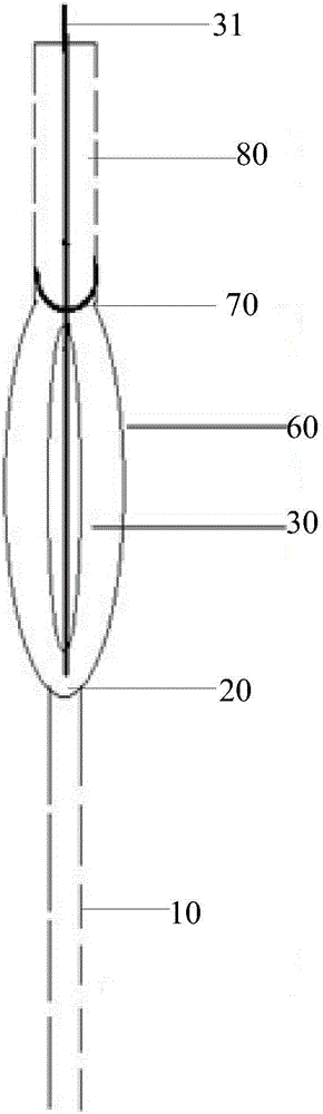 Balloon counterpulsation driven mechanical auxiliary circulating device with valves