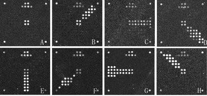 Lyssa virus diagnosing and typing chip and manufacturing method thereof