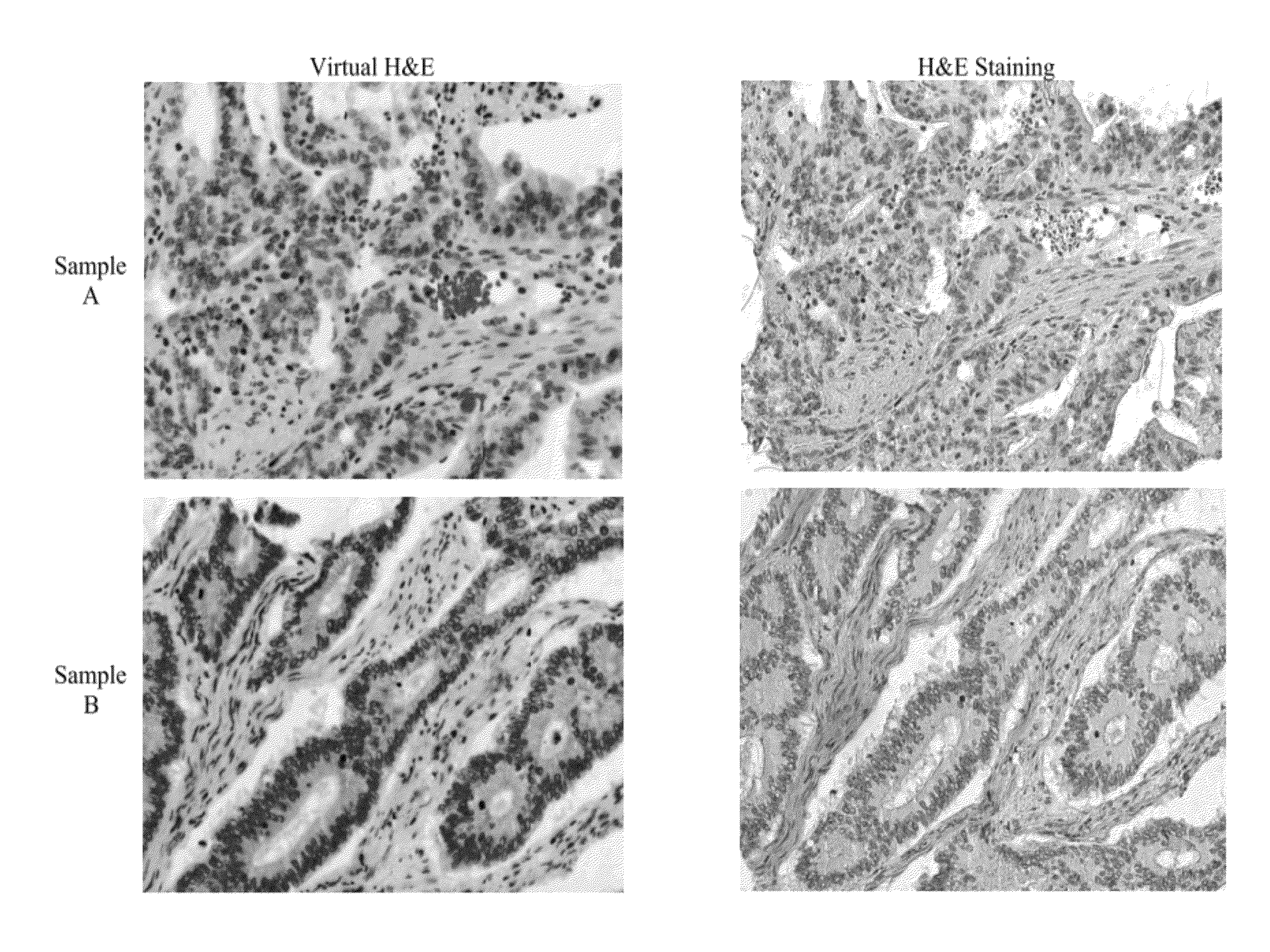 System and methods for mapping fluorescent images into a bright field color space