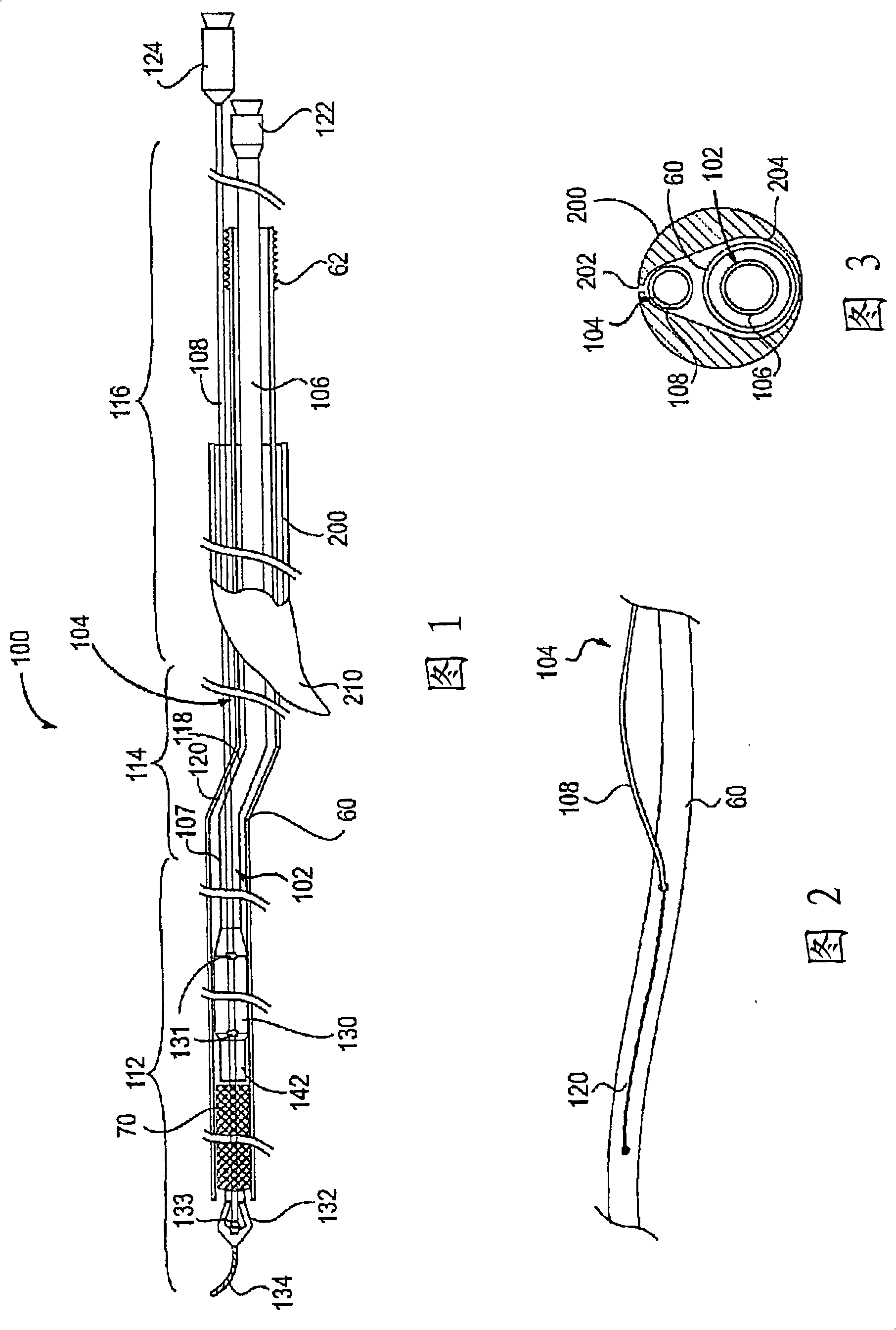 Apparatus and methods for protected angioplasty and stenting at a carotid bifurcation