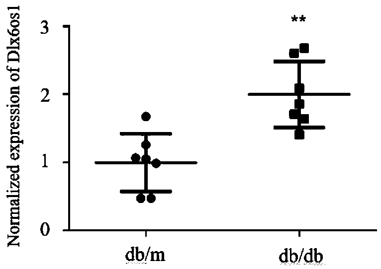 Breeding method for transgenic mouse with conditional knockout of lncRNA DLX6-os1