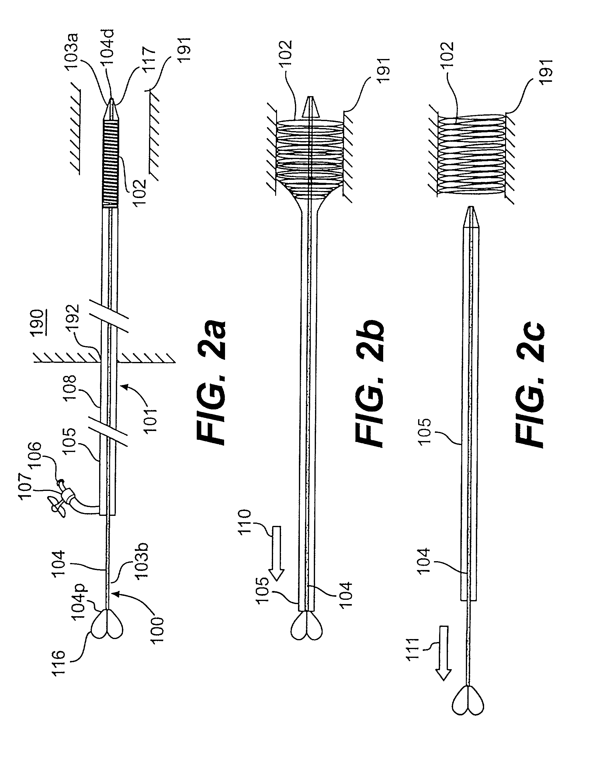 Endoscopic stent delivery system and method