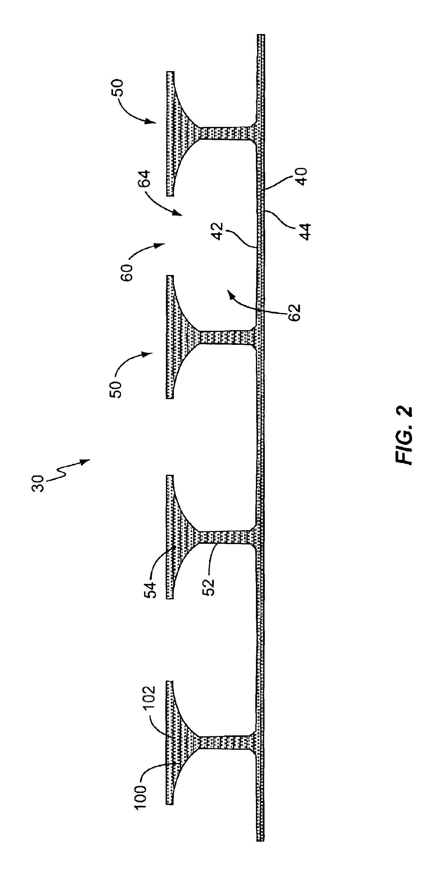 Composite decking system