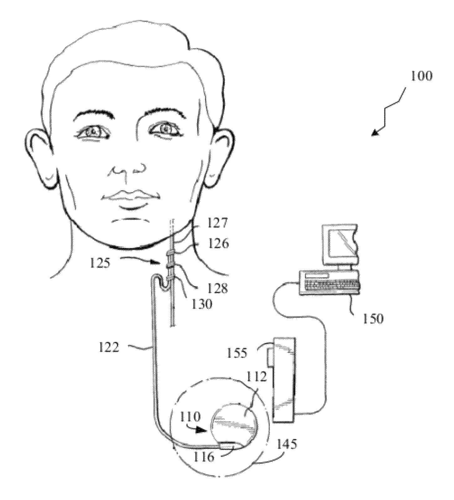 Detecting, quantifying, and/or classifying seizures using multimodal data