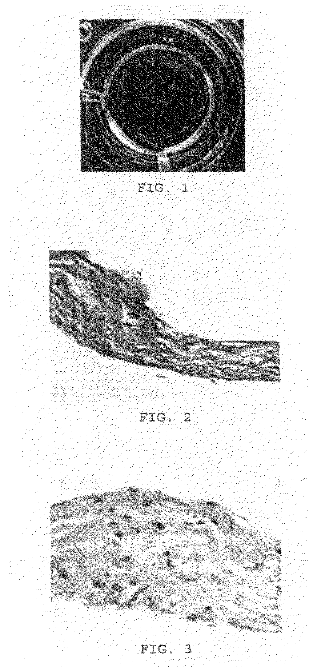 Adhesive cartilage implant