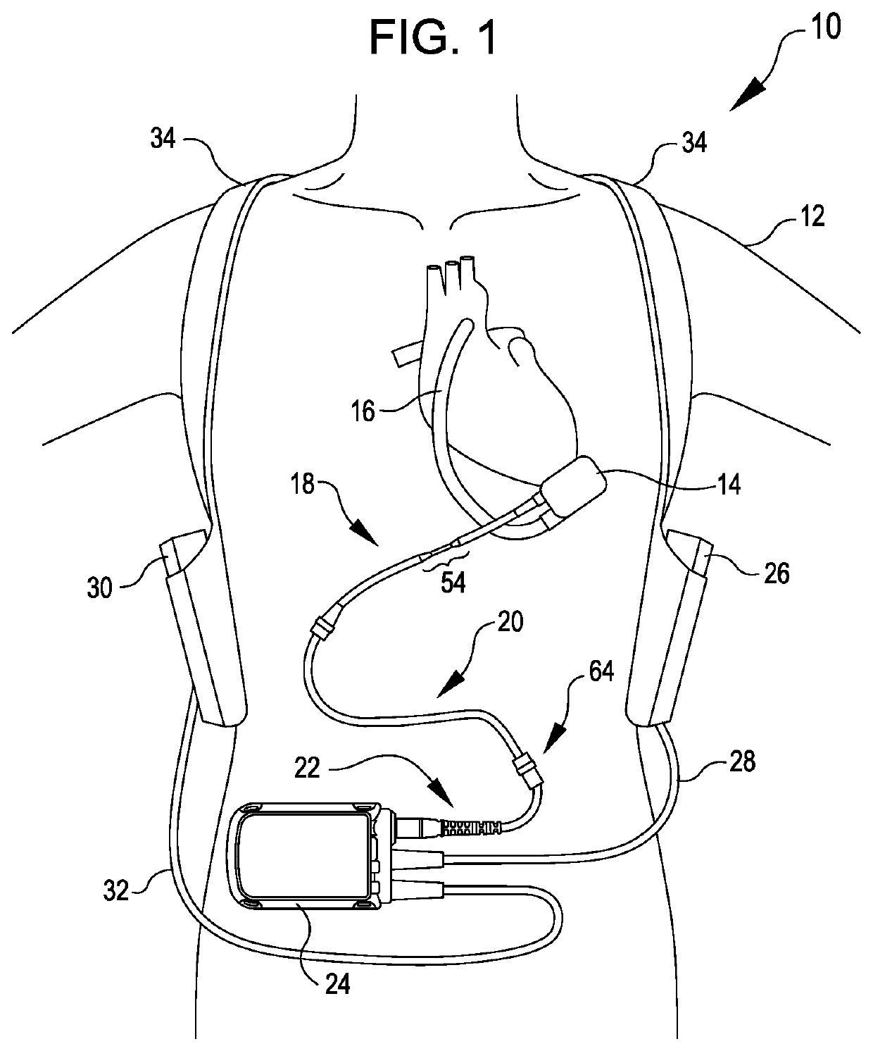 Modular flying lead cable and methods for use with heart pump controllers