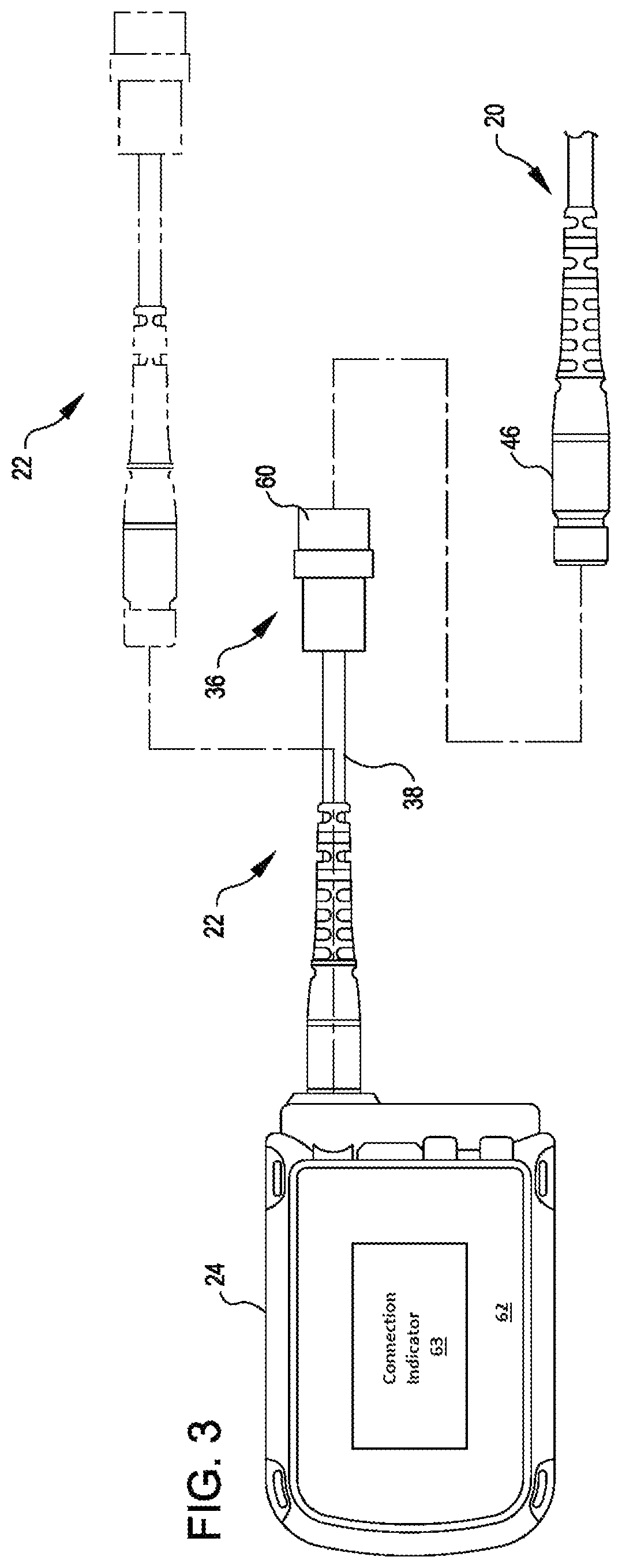 Modular flying lead cable and methods for use with heart pump controllers