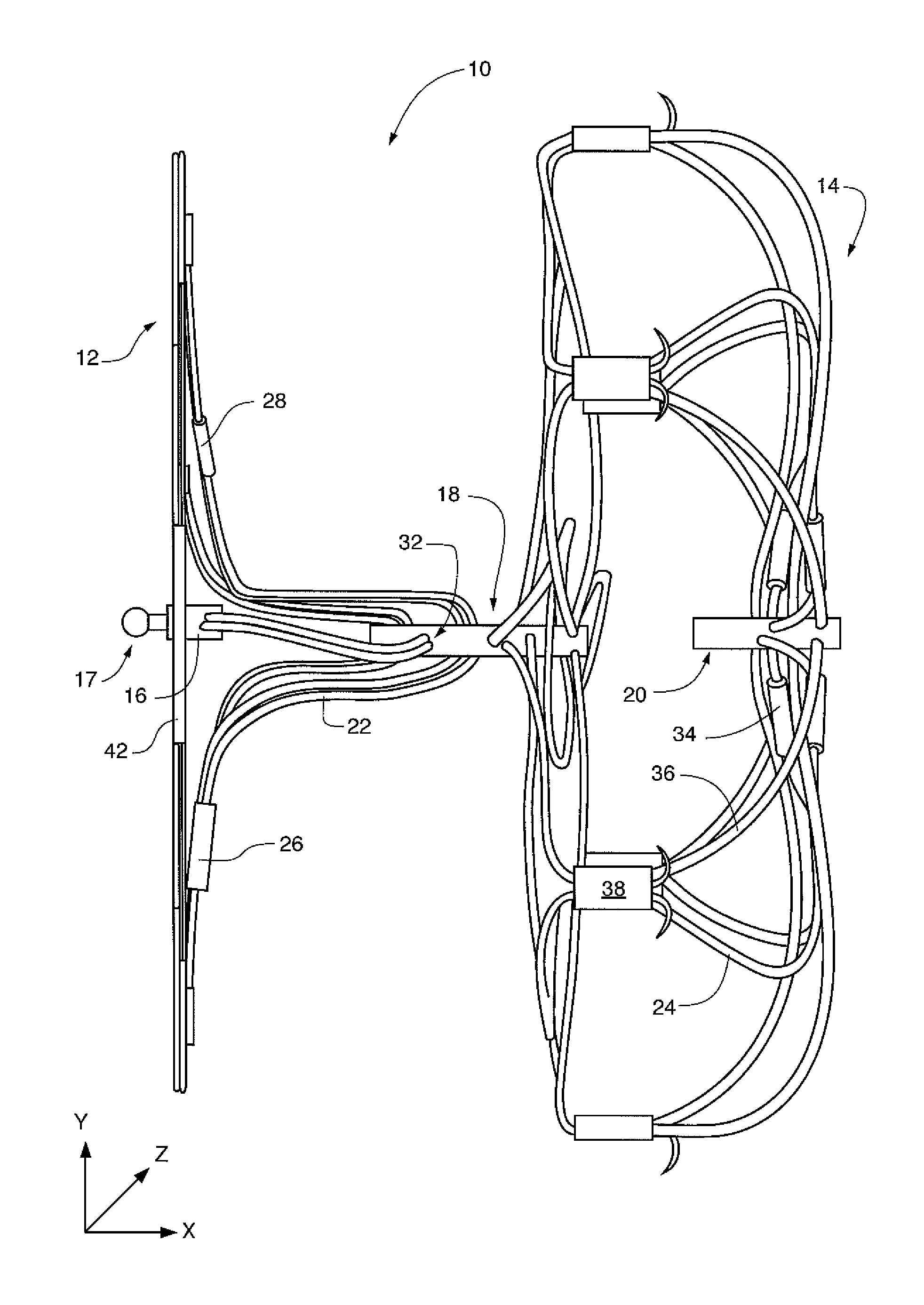 Redeployable left atrial appendage occlusion device