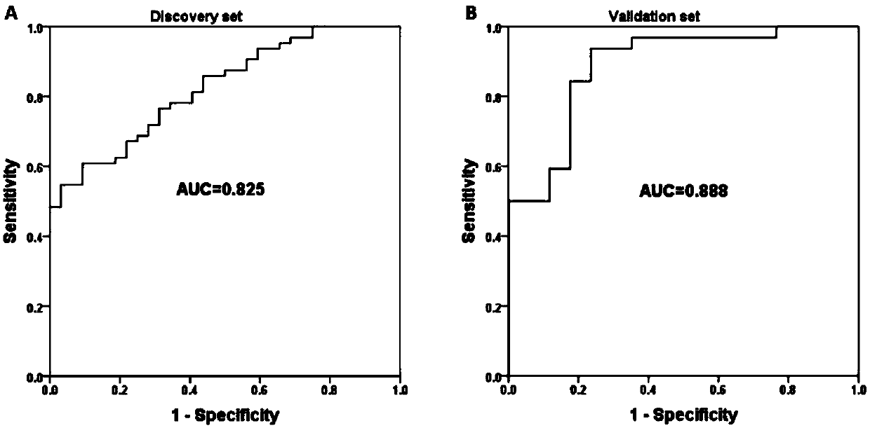 Joint marker for diagnosing bladder cancer, kit and application