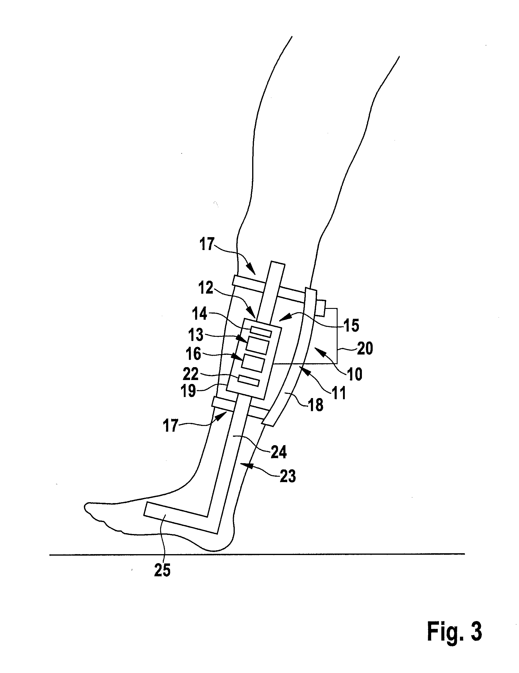 Device and method for electric stimulation of muscles involved in human physiological gait pattern and brace to support an anatomical joint with such device