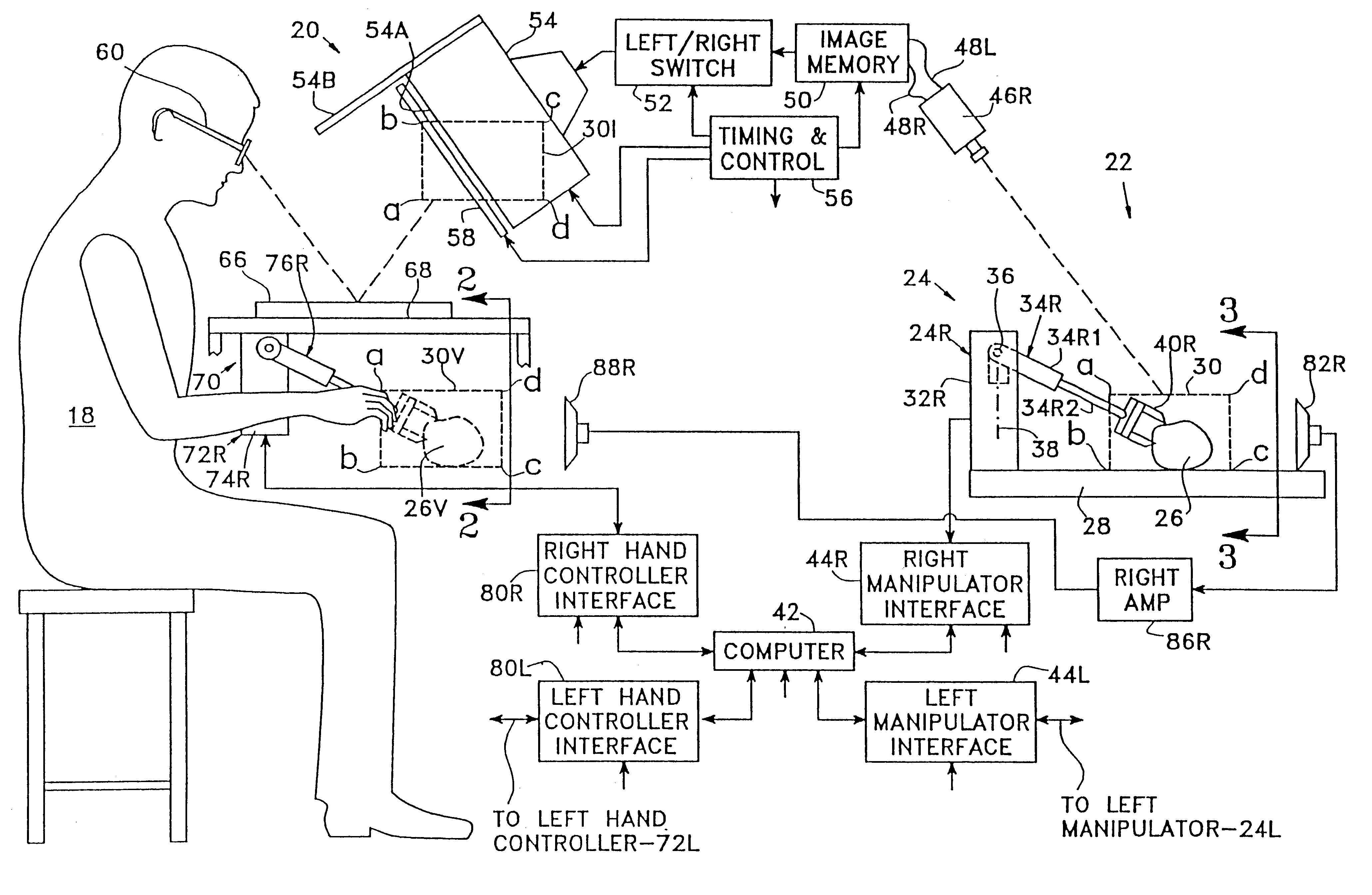 System and method for remote endoscopic surgery