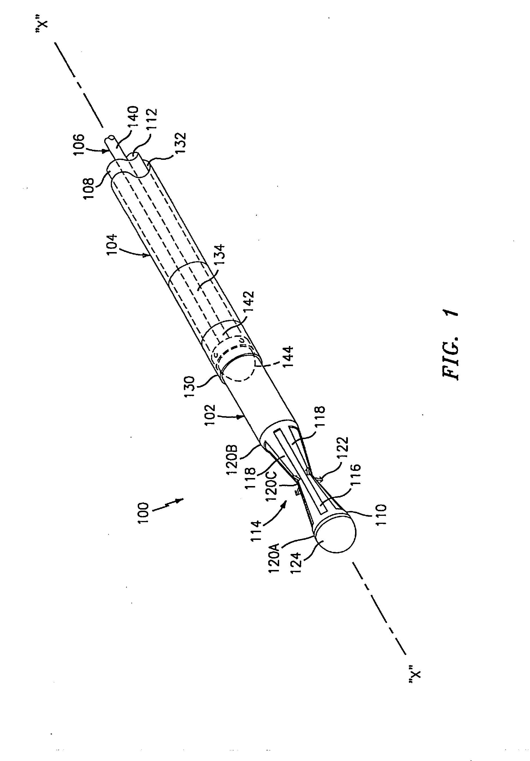 Method and apparatus for anastomosis including an anchoring sleeve