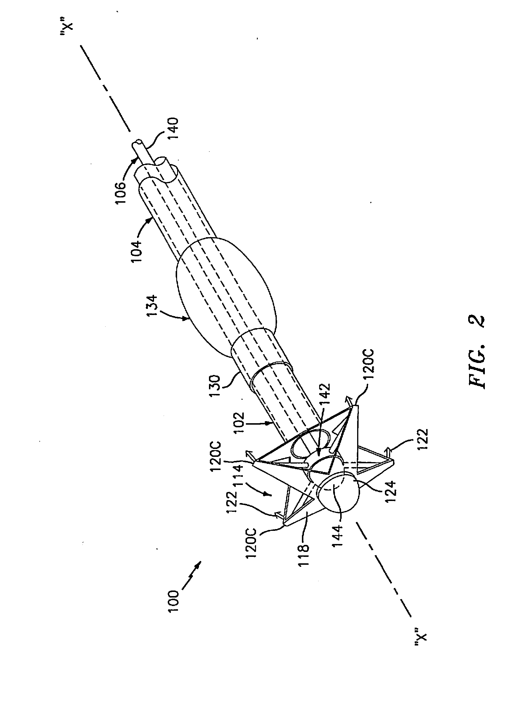 Method and apparatus for anastomosis including an anchoring sleeve