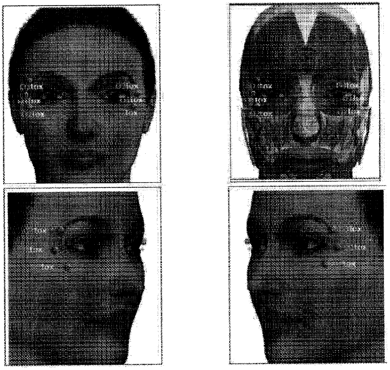 Methods and systems for preventing, correcting, transforming, and modifying facial, aesthetics, and consulting patients regarding the same