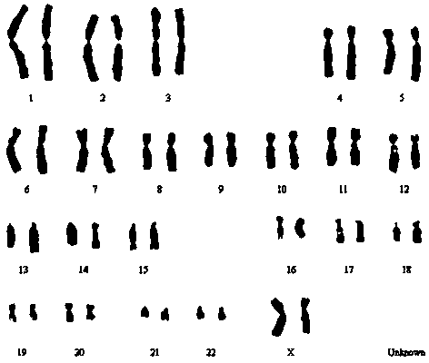 Method for culturing menstrual blood mesenchymal stem cells