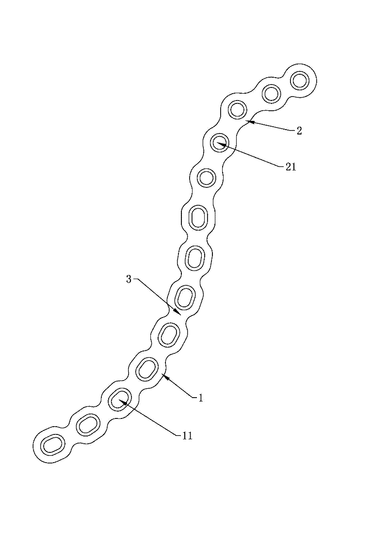 Combined steel plate for iliopectineal