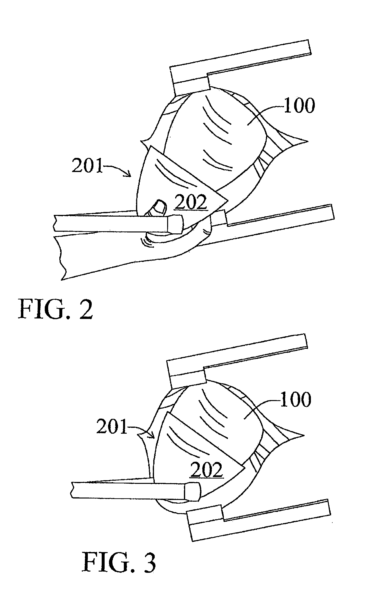 Implantable cardiac assist device with a phased electrode array