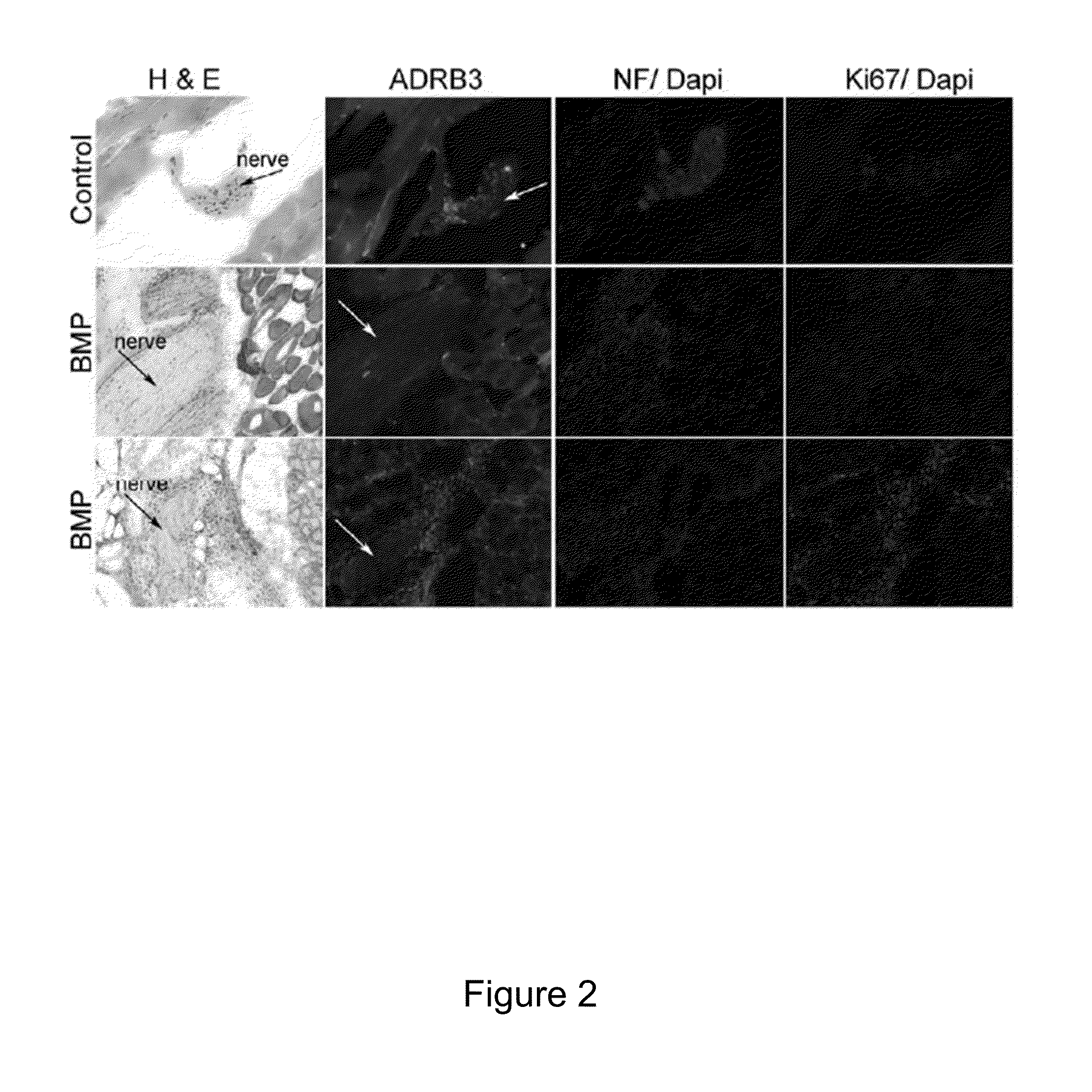 Perineurium Derived Adult Stem Cells and Methods of Use