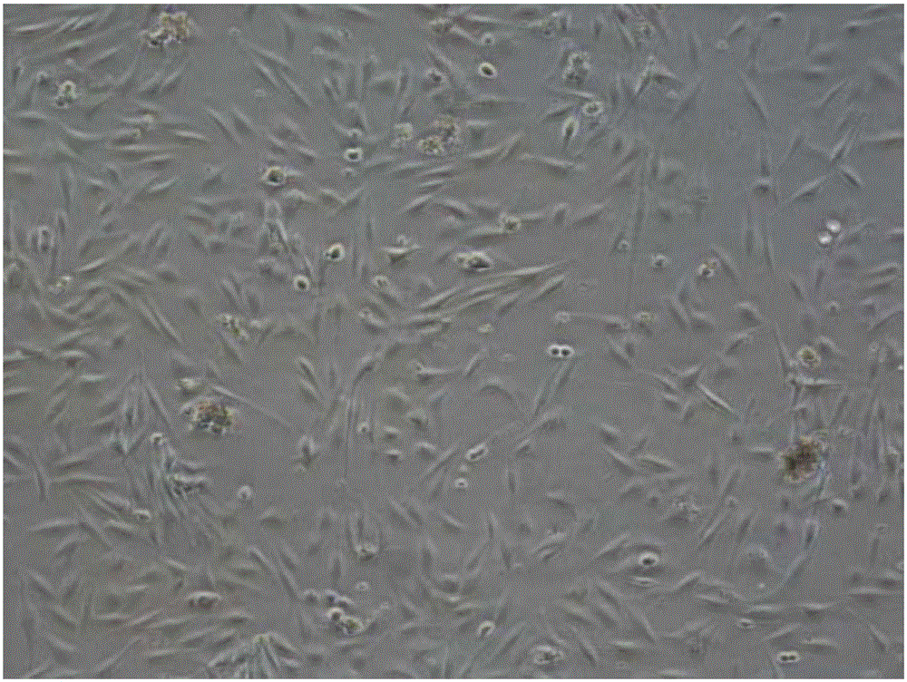 Porcine skeletal muscle satellite cell culture medium PM+ and application thereof