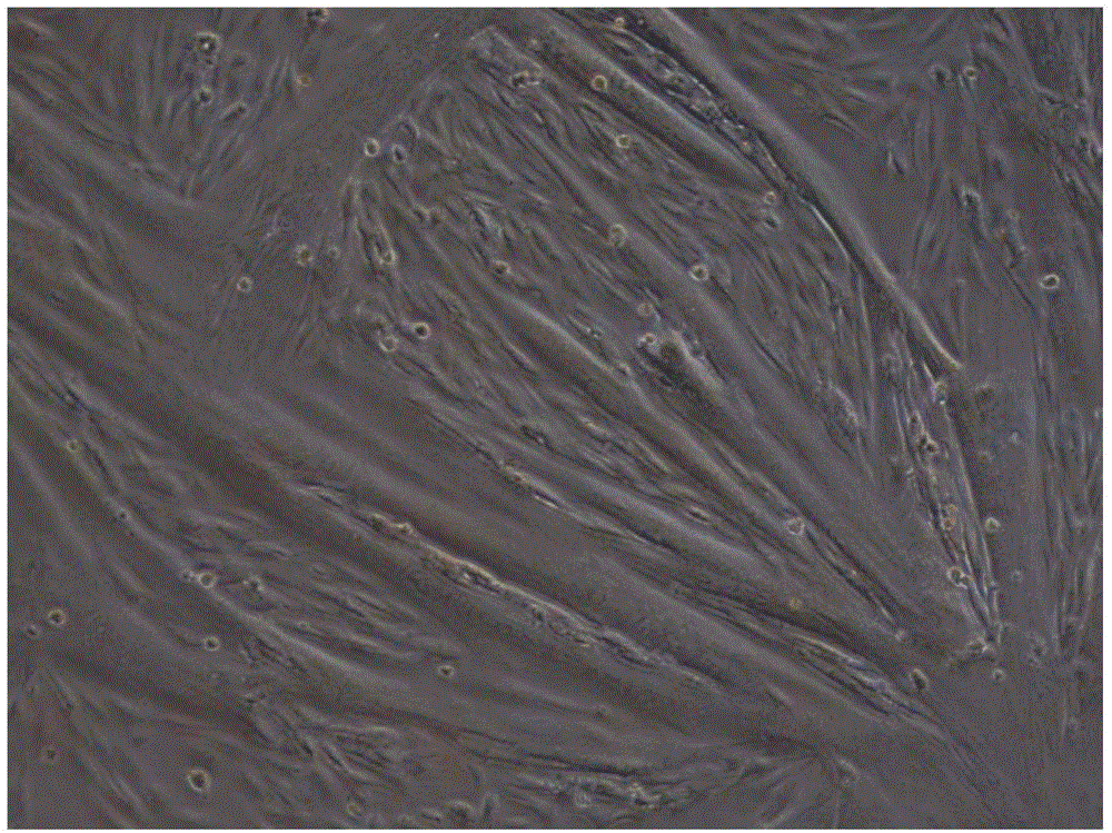 Porcine skeletal muscle satellite cell culture medium PM+ and application thereof