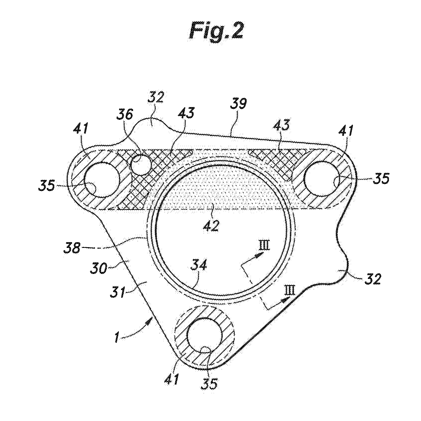 Metal gasket