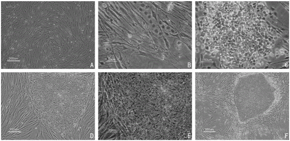 Method for directionally inducing and differentiating induced pluripotent stem cells into vascular endothelium-like cells