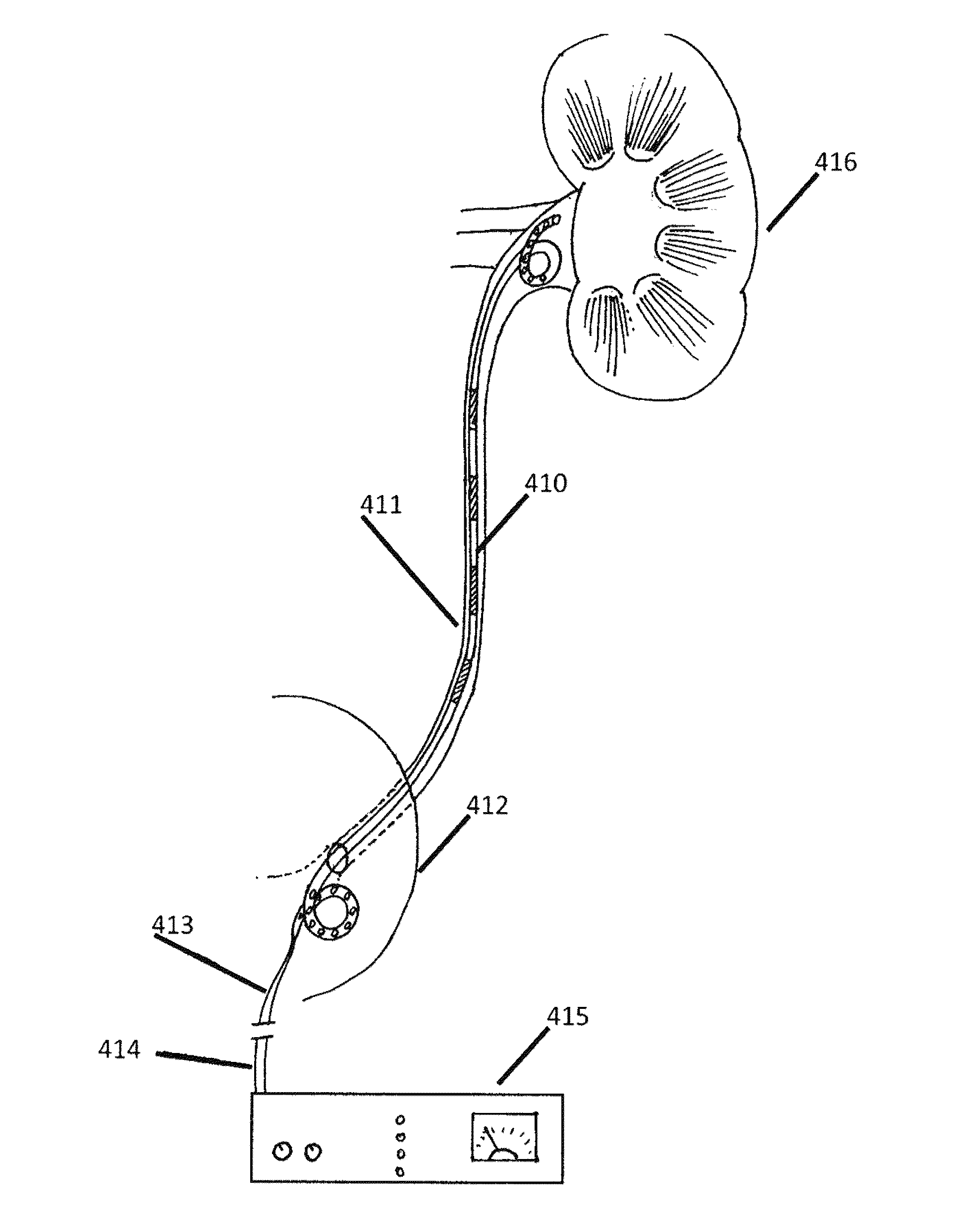 Stimulation of the urinary system