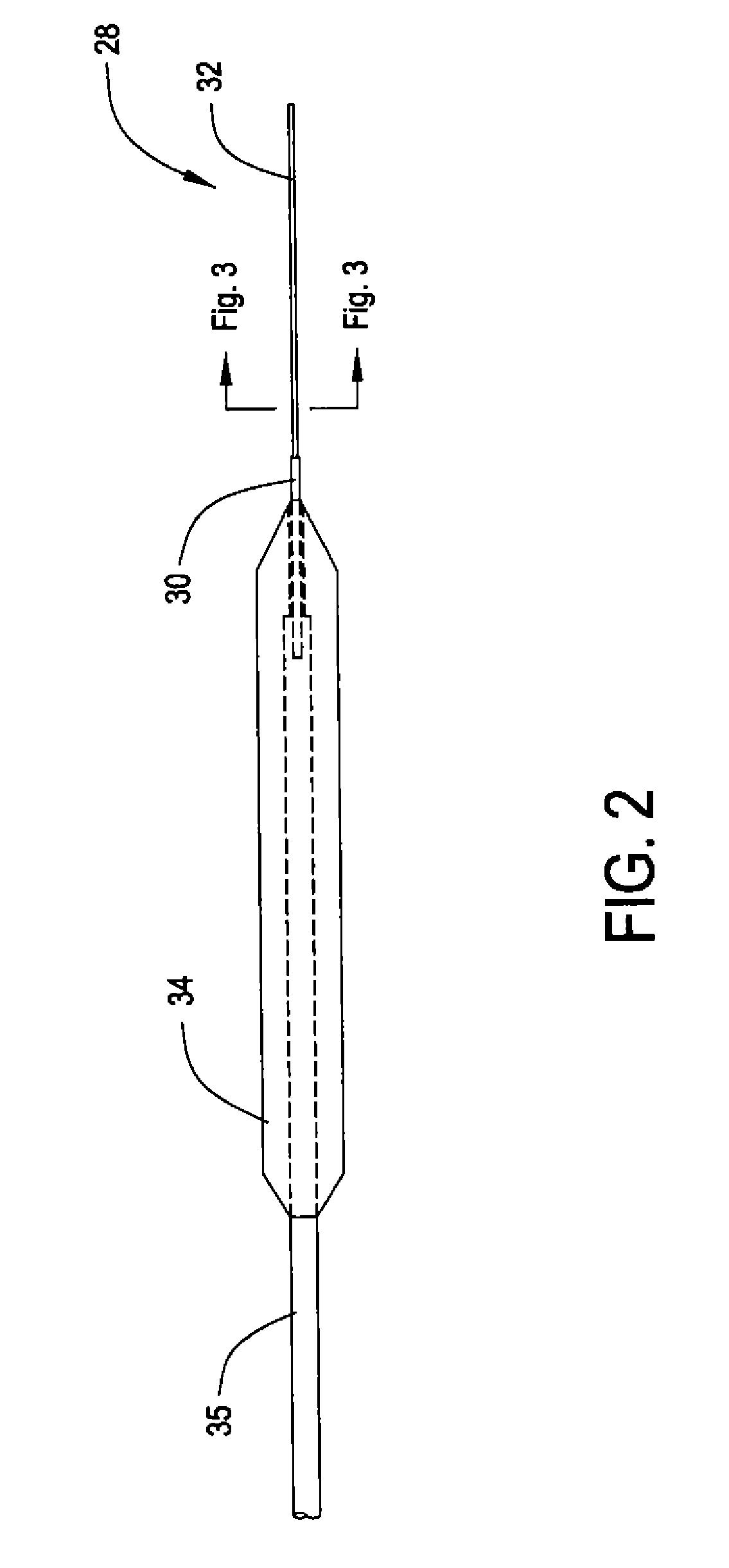 Laser Video Endoscope