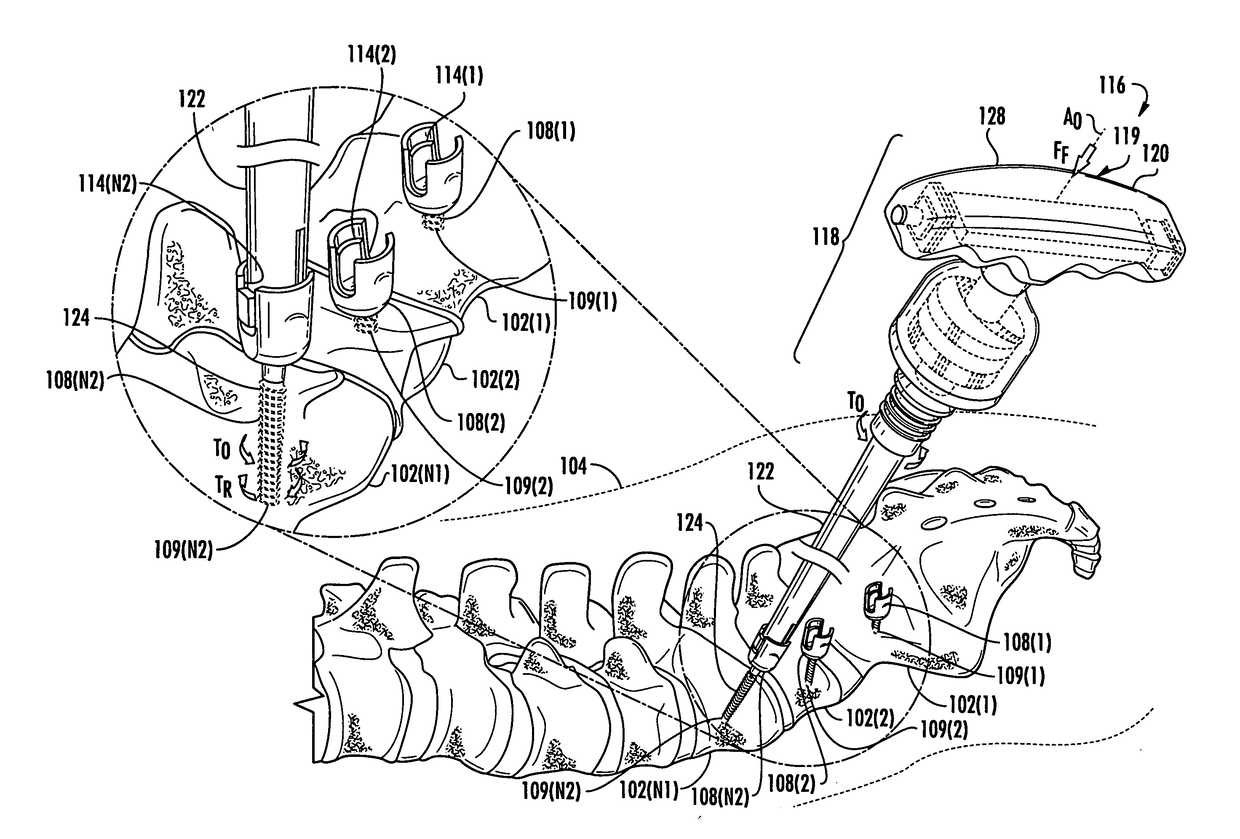 Multi-mode torque drivers employing anti-backdrive units for managing pedicle screw attachments with vertebrae, and related systems and methods