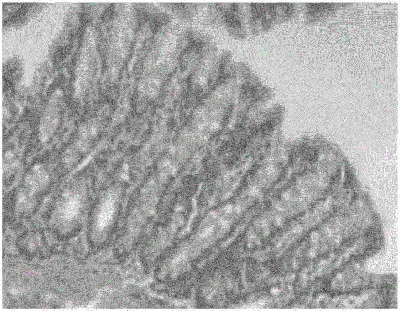 Medicine for treating colitis and application of compound to preparation of medicine for treating colitis