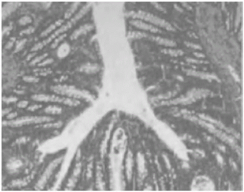 Medicine for treating colitis and application of compound to preparation of medicine for treating colitis