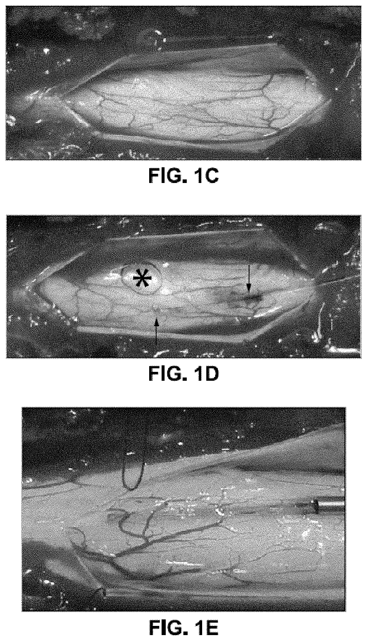 Spinal subpial gene delivery system