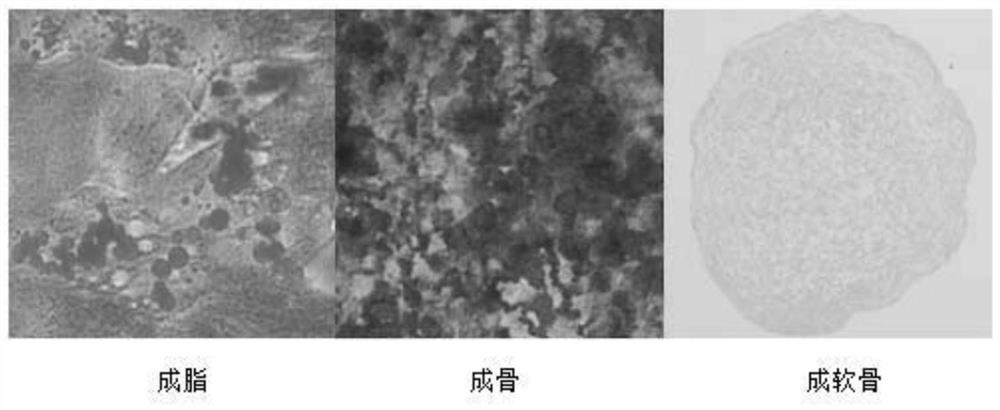 Composition for improving ovarian function and application thereof