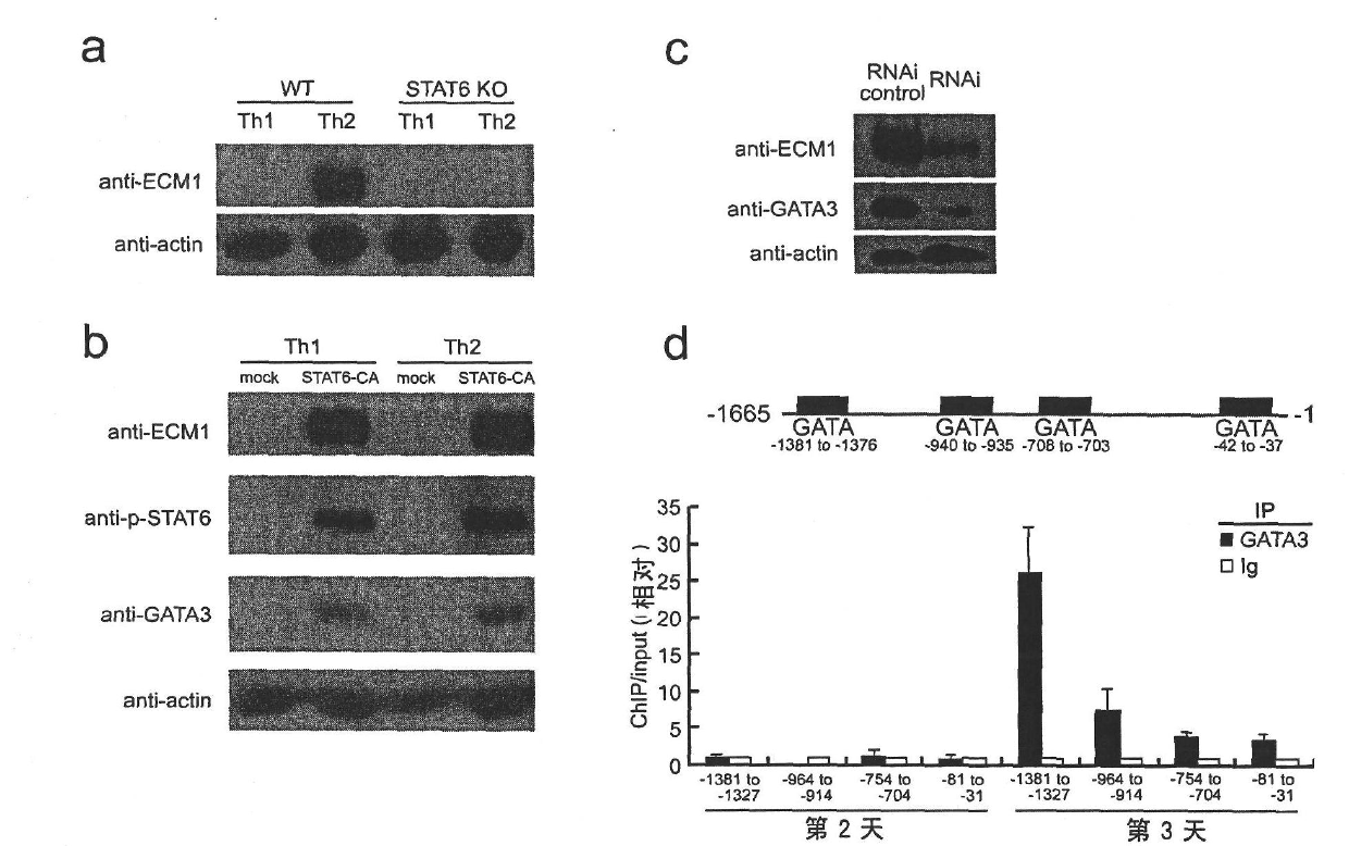 Application of extracellular matrix protein 1 and regulator thereof in preparing medicament for diagnosing or treating allergic diseases