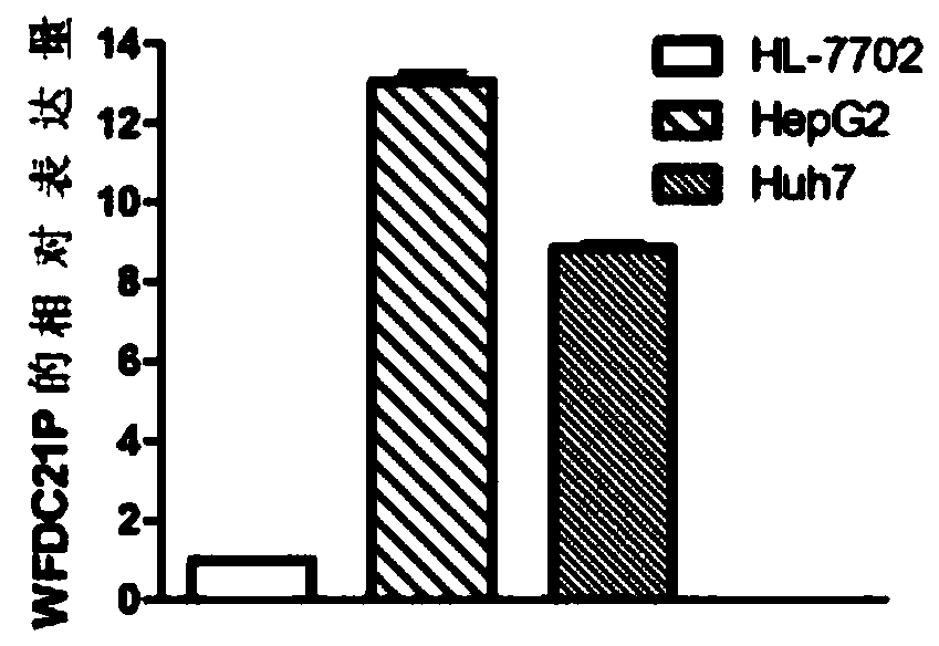 Application of wfdc21p in the diagnosis and treatment of liver cancer