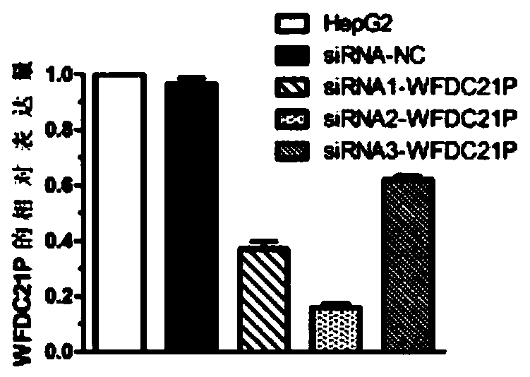 Application of wfdc21p in the diagnosis and treatment of liver cancer