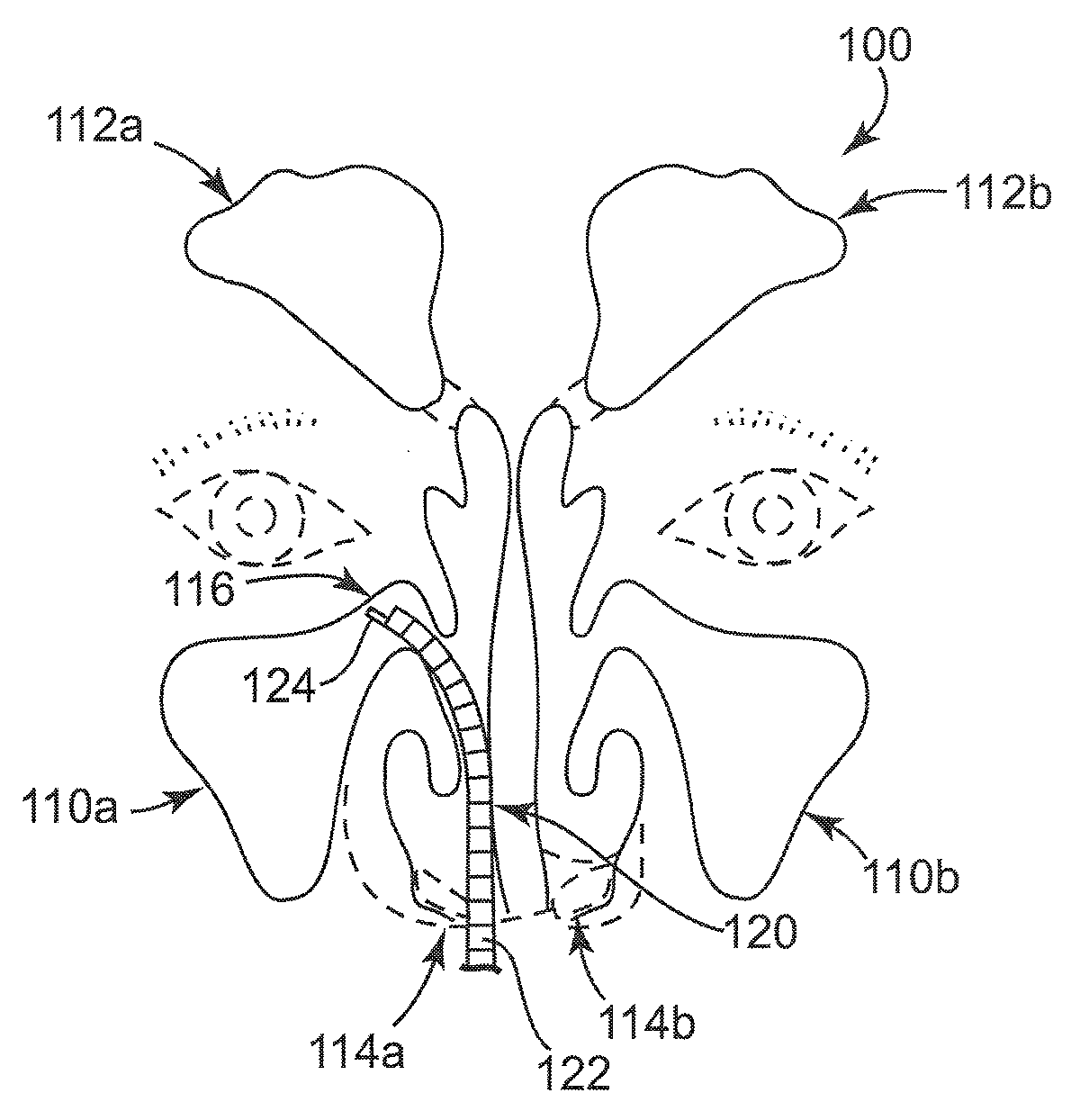 Rehydratable thiolated polysaccharide particles and sponge