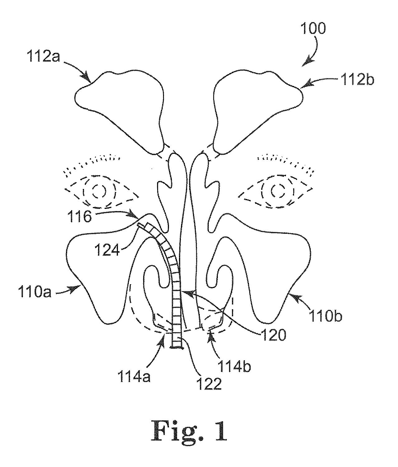 Rehydratable thiolated polysaccharide particles and sponge