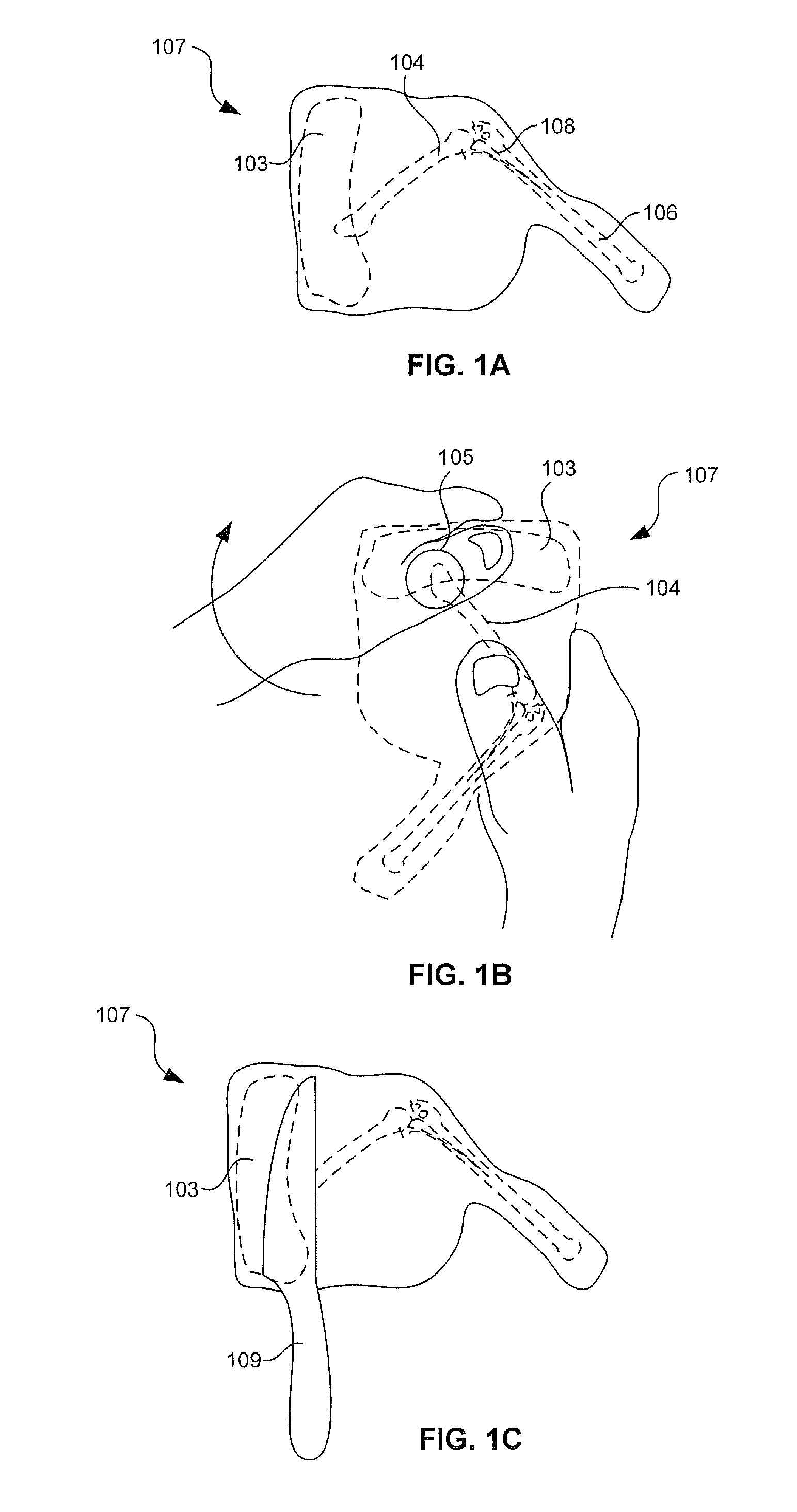 Method for preparing a chicken thigh product