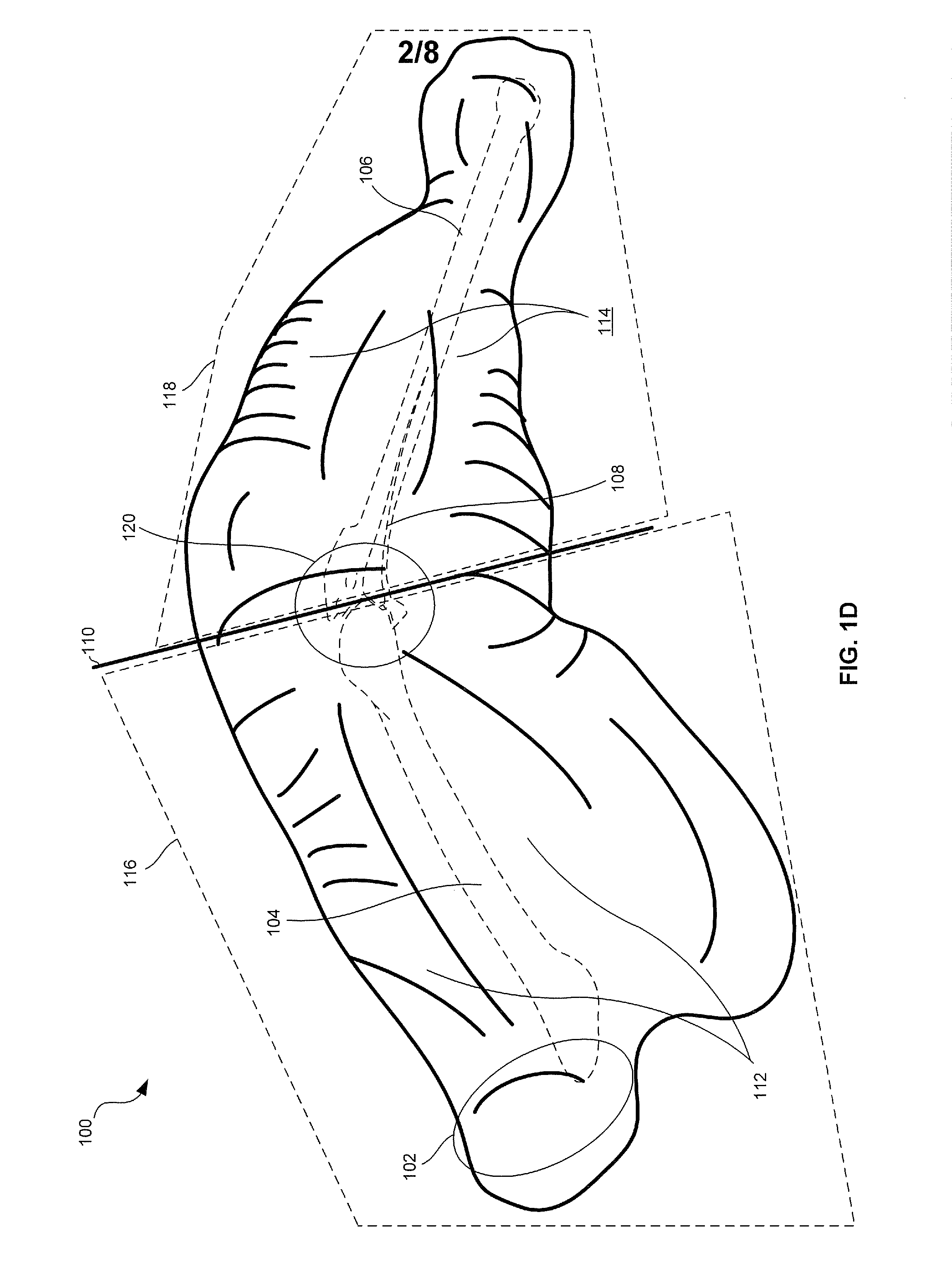 Method for preparing a chicken thigh product