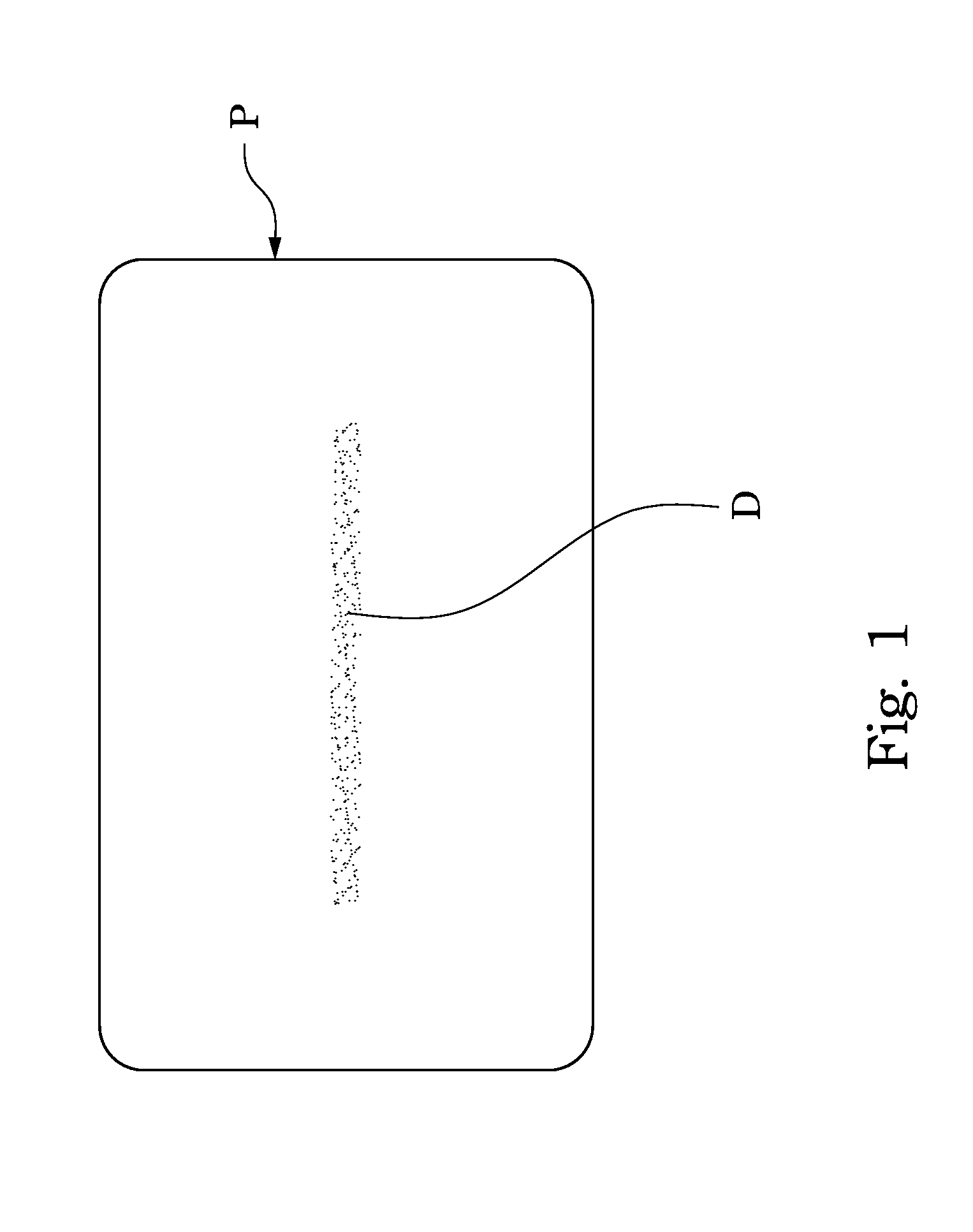 Plastic material injection molding system