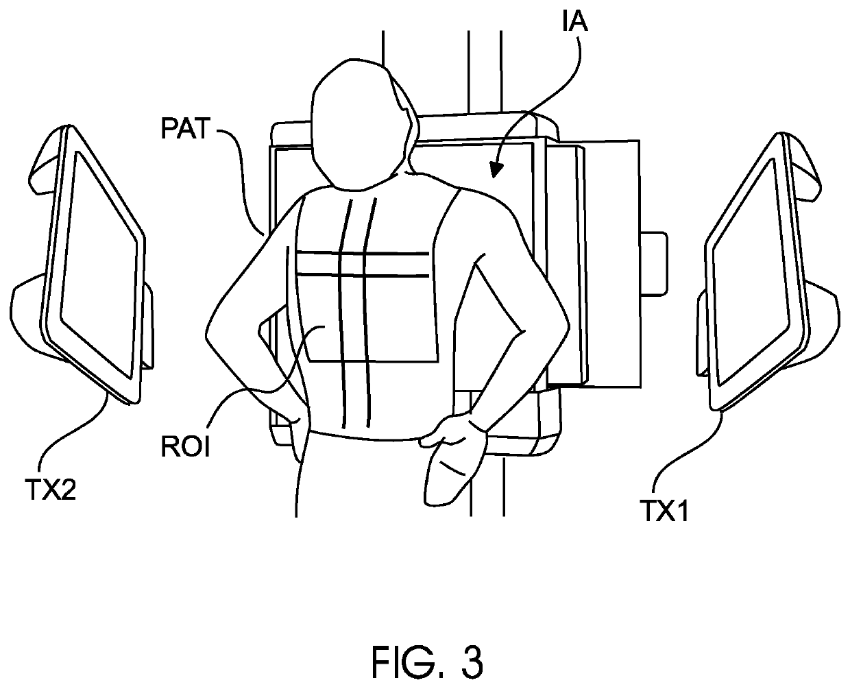 Ultrasonic haptic system for patient nudging