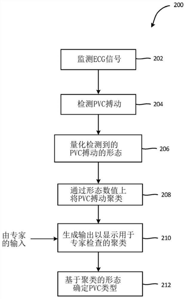 Systems and methods for determining premature ventricular contraction (pvc) type and load