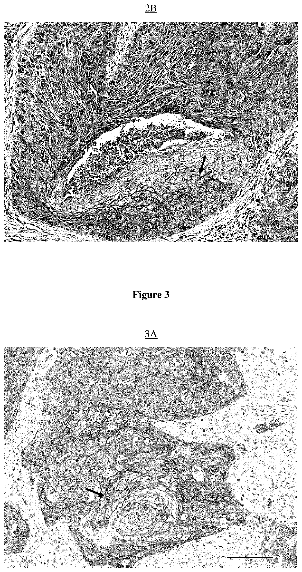 Method of isolating and detecting cancer stem cells