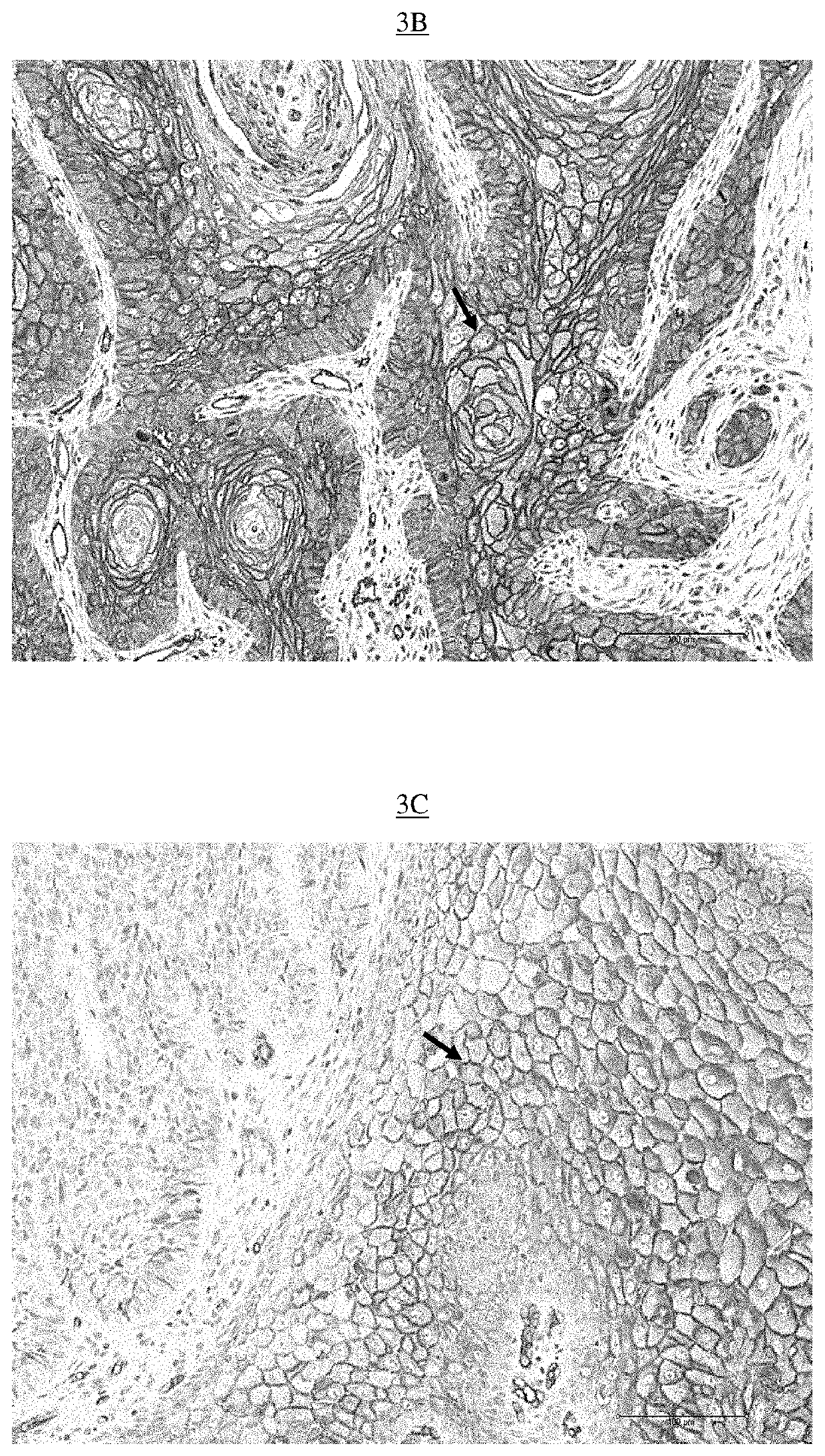 Method of isolating and detecting cancer stem cells