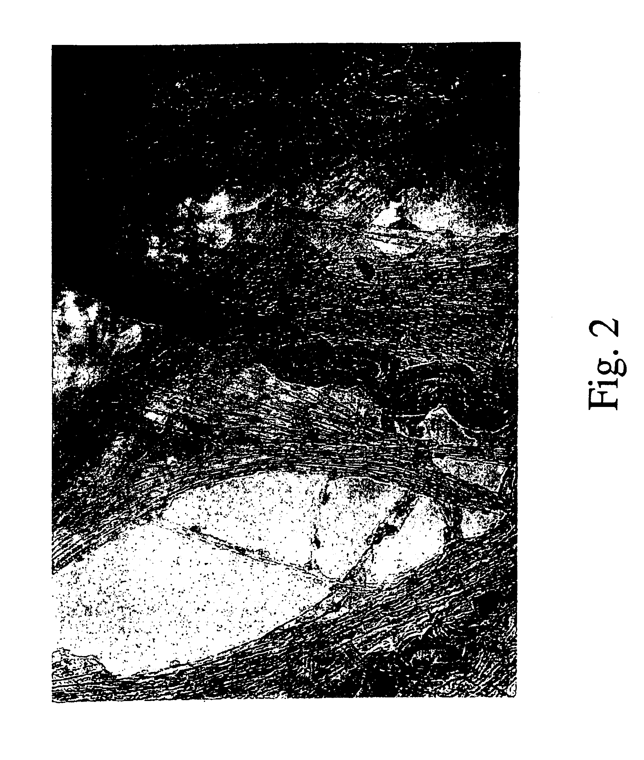 Metallic catalytic particle for producing single-walled carbon nanotubes