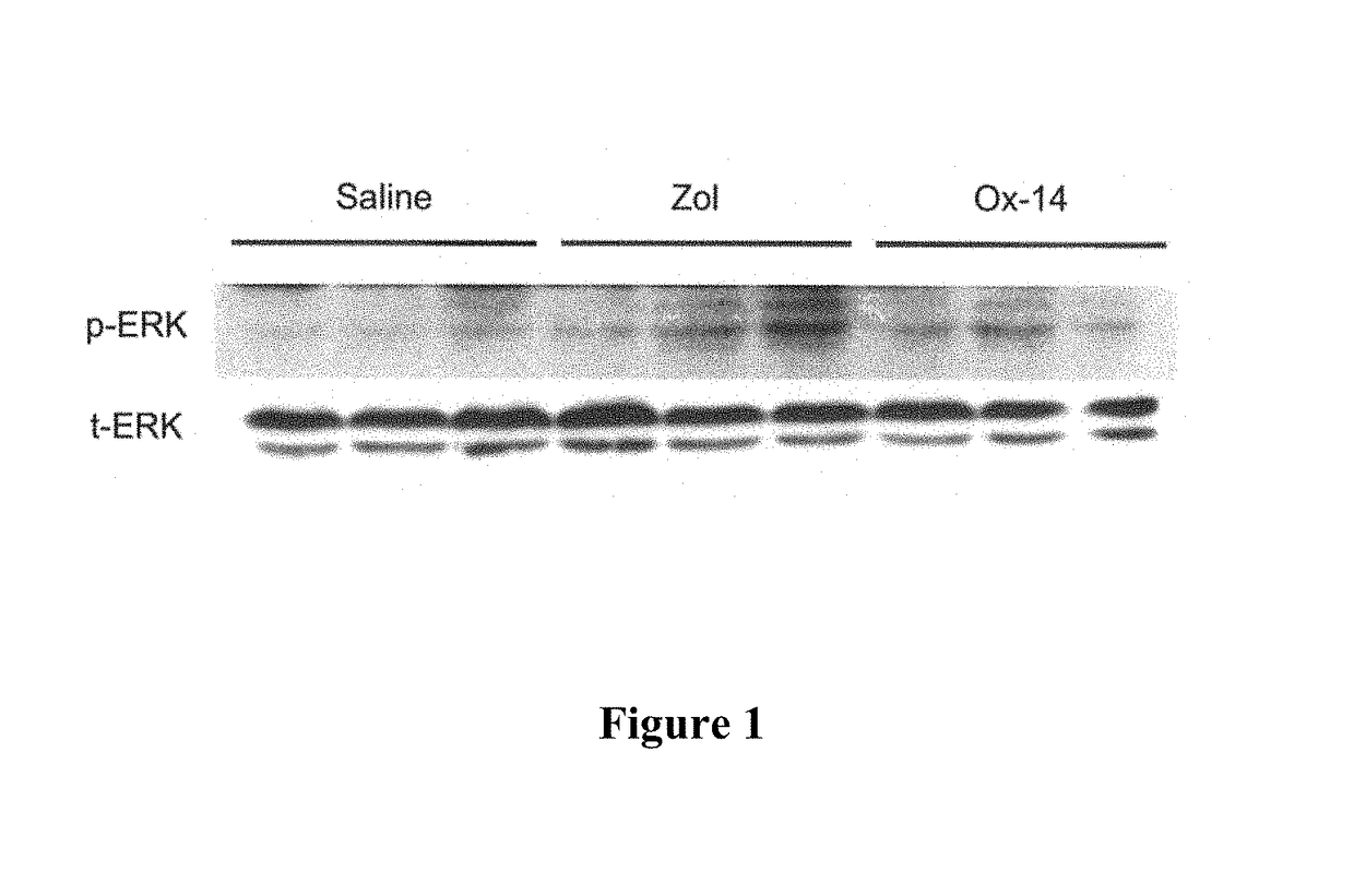 Bisphosphonate compositions and methods for treating and\or reducing cardiac dysfunction