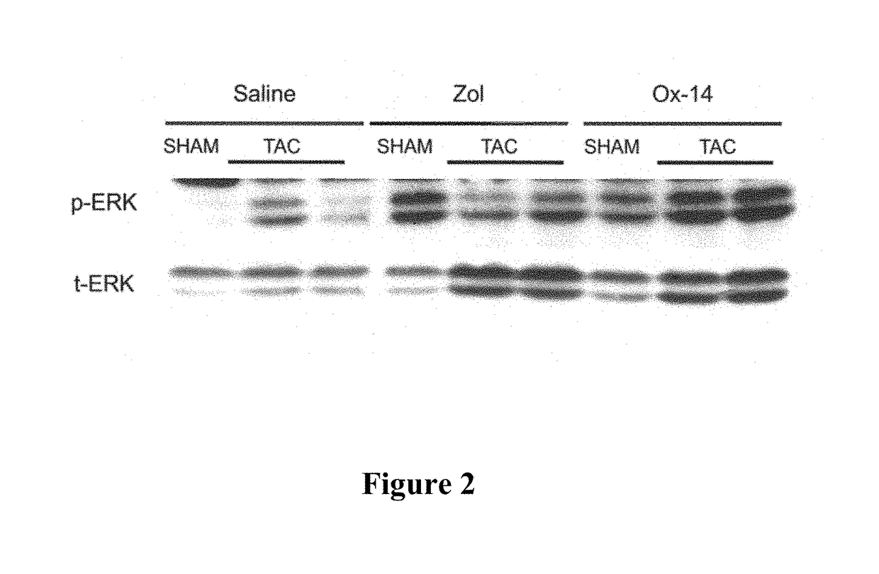 Bisphosphonate compositions and methods for treating and\or reducing cardiac dysfunction