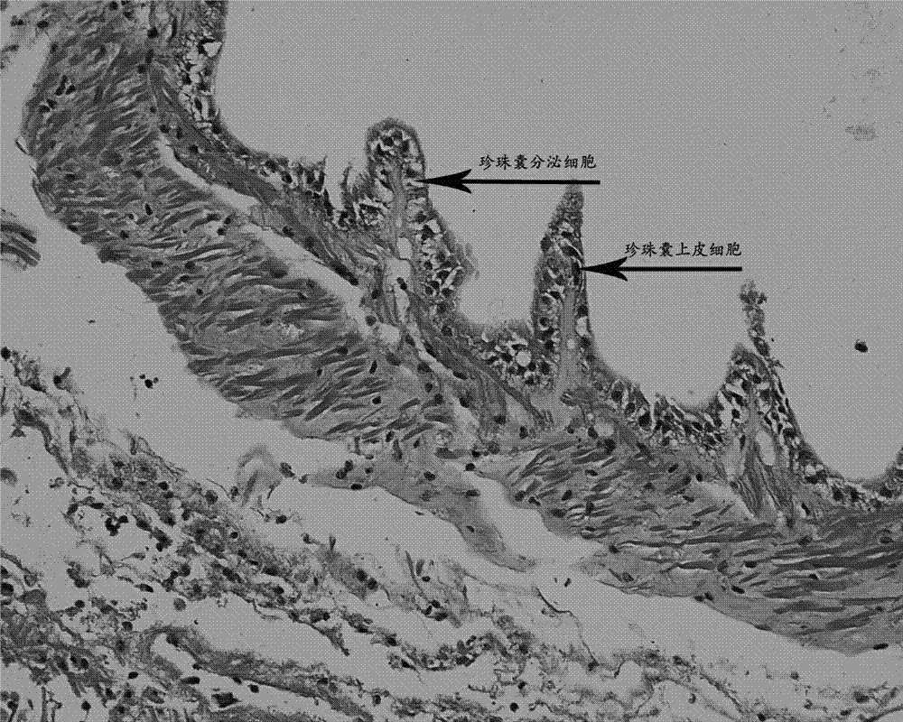 Method for quickly inducing formation of pearl sacs of pearl mussels and promoting pearl growth